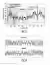 Fig. 06 - Optical storage system divider based DRAW verification with high frequency writing strategy pattern
