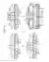 Fig. 20 - Solid-state imaging device, manufacturing method of solid-state imaging device, and electronic device
