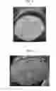 Fig. 04 - Lithium secondary battery and method of fabricating the same