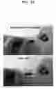 Fig. 15 - POROUS ELECTRODE FOR LITHIUM BATTERY, METHOD OF MANUFACTURING THE SAME, AND LITHIUM BATTERY INCLUDING THE SAME