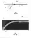 Fig. 07 - Apparatus and method for affecting the radial dimension of guided electromagnetic waves