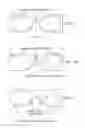 Fig. 04 - Method and apparatus for a wearable imaging device