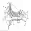 Fig. 01 - BONE CONDUCTION DEVICE SUPPORT