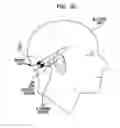 Fig. 06 - BONE CONDUCTION DEVICE SUPPORT