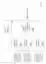 Fig. 05 - Noise estimation for dynamic sound adjustment