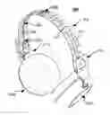 Fig. 01 - Headband for a pair of headphones, a corresponding pair of headphones and a method of providing the headband