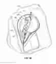 Fig. 25 - Electrically heated garment