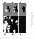 Fig. 02 - Use of Recombinant Human Activated Protein C to Enhance Viability of Transplant Tissue