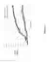 Fig. 03 - Use of Recombinant Human Activated Protein C to Enhance Viability of Transplant Tissue