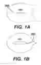 Fig. 02 - Perspiration redirecting band