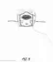 Fig. 08 - Modular face mask