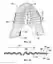Fig. 09 - Article of footwear with knitted component having plurality of graduated projections