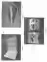 Fig. 03 - HEAD-MOUNTABLE VIEWER