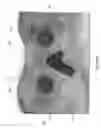 Fig. 12 - HEAD-MOUNTABLE VIEWER