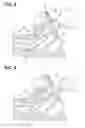 Fig. 07 - Marking method and resecting method