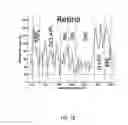 Fig. 03 - Method and device for the non-invasive indirect identification of sites of alterations of the blood-retinal barrier