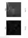 Fig. 07 - Method and device for the non-invasive indirect identification of sites of alterations of the blood-retinal barrier