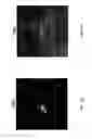Fig. 16 - Method and device for the non-invasive indirect identification of sites of alterations of the blood-retinal barrier