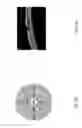 Fig. 19 - Method and device for the non-invasive indirect identification of sites of alterations of the blood-retinal barrier
