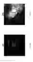 Fig. 26 - Method and device for the non-invasive indirect identification of sites of alterations of the blood-retinal barrier