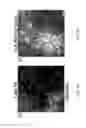 Fig. 28 - Method and device for the non-invasive indirect identification of sites of alterations of the blood-retinal barrier