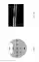 Fig. 29 - Method and device for the non-invasive indirect identification of sites of alterations of the blood-retinal barrier