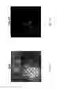 Fig. 31 - Method and device for the non-invasive indirect identification of sites of alterations of the blood-retinal barrier