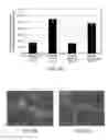 Fig. 07 - MOLECULAR IMAGING METHODS FOR DIAGNOSIS AND EVALUATION OF OCULAR AND SYSTEMIC DISEASES