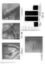 Fig. 08 - MOLECULAR IMAGING METHODS FOR DIAGNOSIS AND EVALUATION OF OCULAR AND SYSTEMIC DISEASES