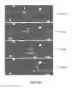 Fig. 13 - MOLECULAR IMAGING METHODS FOR DIAGNOSIS AND EVALUATION OF OCULAR AND SYSTEMIC DISEASES
