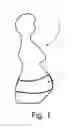 Fig. 02 - Sound-generating device for in utero interactions with a developing fetus