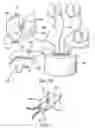 Fig. 08 - System and Method for Assisted Partitioning of Body Conduits