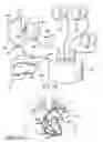 Fig. 10 - System and Method for Assisted Partitioning of Body Conduits