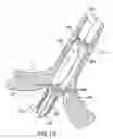 Fig. 13 - System and Method for Assisted Partitioning of Body Conduits
