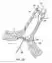 Fig. 14 - System and Method for Assisted Partitioning of Body Conduits