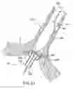 Fig. 15 - System and Method for Assisted Partitioning of Body Conduits
