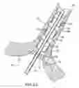 Fig. 16 - System and Method for Assisted Partitioning of Body Conduits