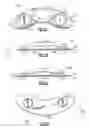 Fig. 02 - Body worn physiological sensor device having a disposable electrode module