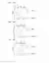 Fig. 11 - Body state detecting apparatus, body state detecting method and bed system