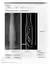 Fig. 01 - Systems and methods for autonomous intravenous needle insertion