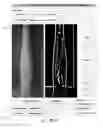 Fig. 27 - Systems and methods for autonomous intravenous needle insertion