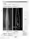 Fig. 28 - Systems and methods for autonomous intravenous needle insertion