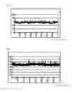 Fig. 04 - SLEEP STAGE DETERMINATION APPARATUS AND SLEEP STAGE DETERMINATION METHOD