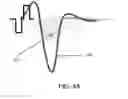 Fig. 05 - Eliminating acquisition-related artifacts in electrophysiological recording
