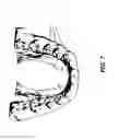 Fig. 08 - Method and apparatus for x-ray scan of occlusal dental casts