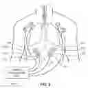 Fig. 05 - System for positioning an intubation tube
