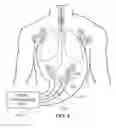 Fig. 06 - System for positioning an intubation tube