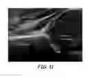 Fig. 10 - Surface modeling of a segmented echogenic structure for detection and measurement of anatomical anomalies
