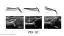 Fig. 11 - Surface modeling of a segmented echogenic structure for detection and measurement of anatomical anomalies