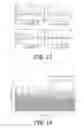 Fig. 12 - Surface modeling of a segmented echogenic structure for detection and measurement of anatomical anomalies